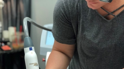 Laser Skin Resurfacing Photo